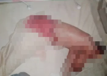 Hunters arraigned in court for allegedly killing man, setting his corpse ablaze in Adamawa