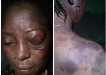 Woman allegedly battered by her husband over disagreement with his girlfriend in Rivers