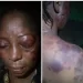 Woman allegedly battered by her husband over disagreement with his girlfriend in Rivers