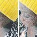 Girl contracts rare skin disease from ‘invisible snake that licks her up’