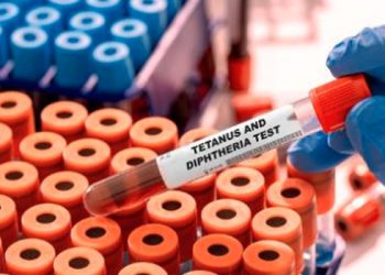 61 Die Of Diphtheria In Kano