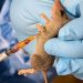 Lassa fever kills 152 in 15 weeks