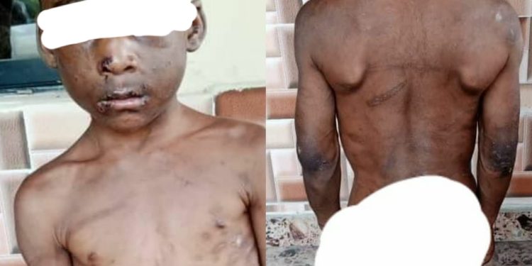 Horrific photos of a child brutalized, chained for weeks by his guardian in Abia