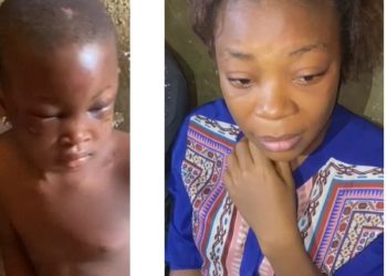 Couple arrested for allegedly using pestle, heated knife to assault their 9-year-old househelp