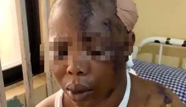 Husband machetes wife over sexual harassment allegation