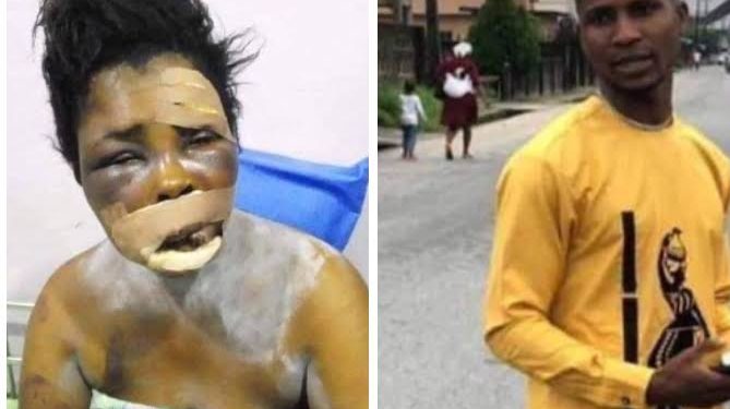 How my son tries to remove my eye for money ritual – Mother reveals