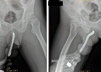 Chinese scientists successfully clone two goats