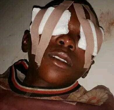 Suspected ritualists remove young boy’s eyes in Bauchi