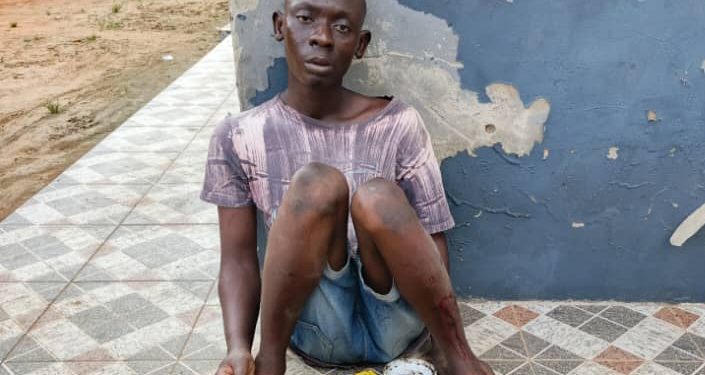 29-year-old suspected ritualist nabbed with human jaw