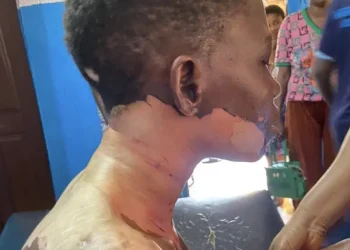 Man pours hot oil, stabs wife during disagreement in Ogun