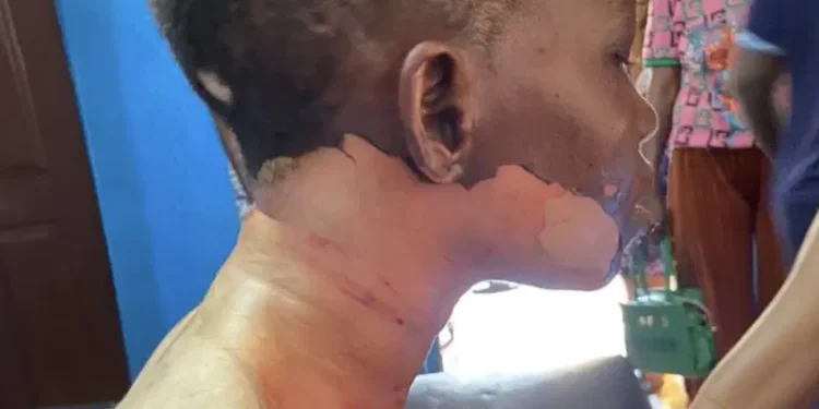 Man pours hot oil, stabs wife during disagreement in Ogun