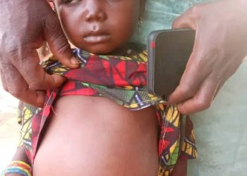 Mysterious Disease Hits Sokoto Community, 32 Children Affected
