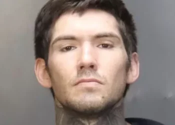 35-year-old man burns girlfriend, 64, for talking too much