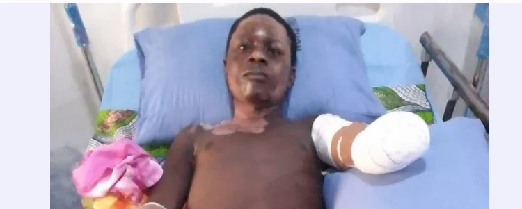 Taraba Poly student loses both hands after electrocution while hoisting PDP flag