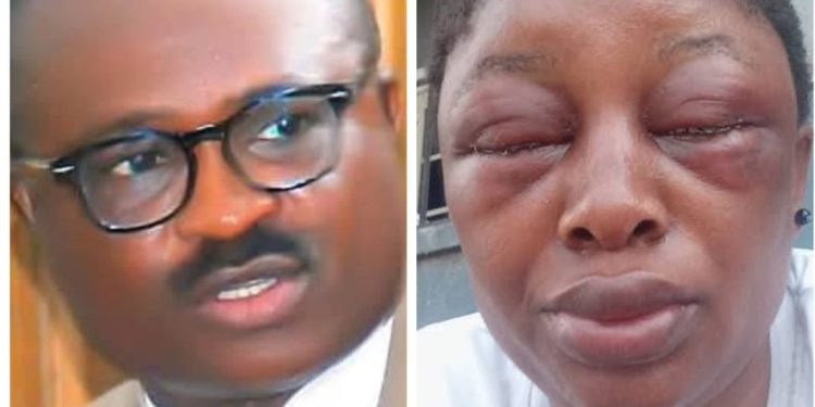 Police arrest Cross River lawmaker over domestic violence, wife battery
